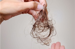 12 lý do tiềm ẩn dẫn đến rụng tóc