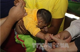 Giám sát trẻ sơ sinh mắc chứng đầu nhỏ ở Đắk Lắk