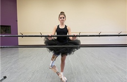 Nghị lực phi thường của vũ công ballet với cẳng chân giả