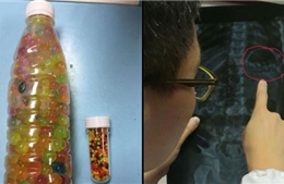 Cho con 3 tuổi ăn hàng trăm viên hạt nhựa vì tưởng kẹo