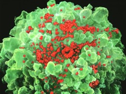 Chấn động: Vaccine AIDS cứu 5 bệnh nhân ‘sạch’ HIV trong 7 tháng