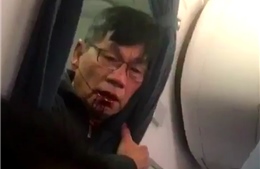 United Airlines mất tỉ đô, nạn nhân gốc Việt thành triệu phú nếu thắng kiện