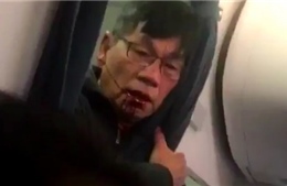Lãnh đạo United Airlines xin lỗi trước Quốc hội về vụ kéo hành khách gốc Việt