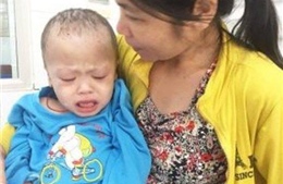  Mẹ nghèo bất lực nhìn con trai 5 tuổi nguy cơ tử vong vì bệnh lạ