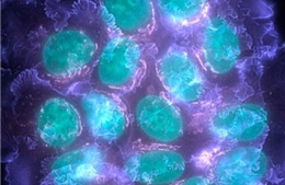 Xác định được các gene đột biến có khả năng gây ung thư vú