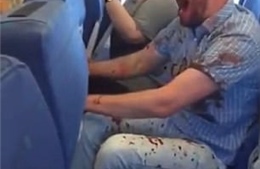 Hành khách say rượu, đổ máu be bét trên chuyến bay