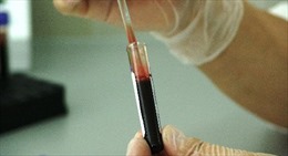 Phương pháp thử máu mới phát hiện ung thư trước khi có triệu chứng