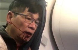 United Airlines &#39;trắng án&#39; vụ hành khách gốc Việt bị đấm chảy máu mồm