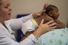 Thử nghiệm hiệu quả vaccine phòng Zika