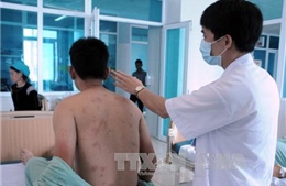 Nhiều nạn nhân bị ong đốt ở Nghệ An đã xuất viện 