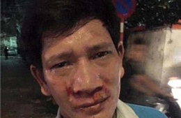 Hà Nội: Thêm một công nhân môi trường bị hành hung 