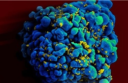 Phát hiện thuốc điều trị ung thư phổi có thể tiêu diệt tế bào nhiễm HIV 