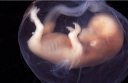 Kỳ tích khoa học: Bào thai chào đời sau 24 năm đông lạnh
