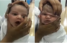 Video y tá &#39;vò mặt&#39; bé sơ sinh gây phẫn nộ