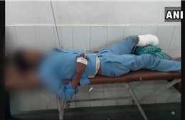 Bác sĩ lấy chân cắt rời của bệnh nhân làm gối đầu gây rúng động dư luận Ấn Độ