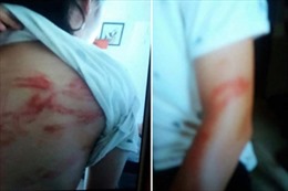 Hai cháu bé ở Hà Nội bị bố bạo hành đang ở nhà bác ruột
