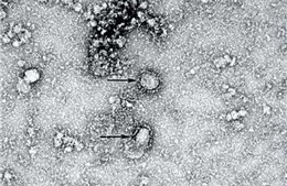Nghiên cứu mới về thời gian ủ bệnh của virus nCoV 