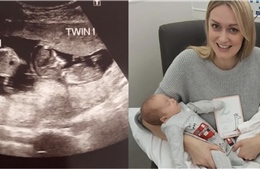 Kỳ lạ người phụ nữ có bầu khi đang mang thai 3 tháng
