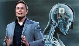 Công ty của Elon Musk được phép thử nghiệm cấy chip vào não người 