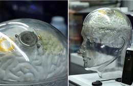 Trung Quốc đuổi sát Mỹ trong công nghệ não bộ, sánh ngang Neuralink