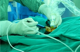 Đốt u phổi bằng thiết bị vi sóng thành công cho lão bệnh nhân 80 tuổi
