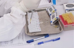 Không thực hiện dịch vụ xét nghiệm virus SARS-CoV-2 theo yêu cầu 