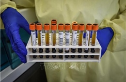 Italy đang nghiên cứu 5 - 6 loại vaccine triển vọng phòng COVID-19