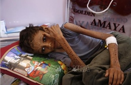 10 triệu người ở Yemen đang bị thiếu lương thực trầm trọng