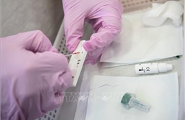 Bộ xét nghiệm giúp phát hiện kháng thể chống virus SARS-CoV-2 chỉ có giá 1 USD