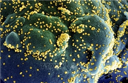 Lượng virus SARS-CoV-2 ở bệnh nhân không triệu chứng tương đương nhóm có triệu chứng