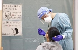 Nhật Bản làm rõ một phần cơ chế khiến bệnh nhân COVID-19 trở nặng