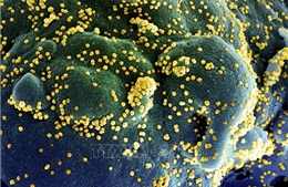 Nghiên cứu mới: Hoạt chất chiết xuất từ tinh dầu khuynh diệp có thể tiêu diệt virus SARS-CoV-2