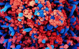 Nghiên cứu cơ chế virus SARS-CoV-2 gây cục máu đông