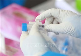 CDC Vĩnh Phúc đủ năng lực xét nghiệm khẳng định SARS-CoV-2