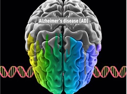Phát hiện mới về nguyên nhân gây bệnh Alzheimer