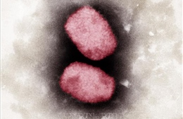 Virus gây bệnh đậu mùa khỉ ở Bồ Đào Nha ít lây lan hơn