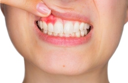 WHO: 45% dân số thế giới mắc các bệnh về răng miệng 