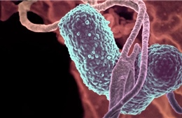 'Lập trình' vi khuẩn đường ruột có lợi để ngăn chặn bệnh não gan