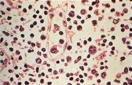 Virus Hanta: Israel ghi nhận ca nhiễm đầu tiên ở trong nước