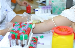 Hỗ trợ 6.500 xét nghiệm chẩn đoán Viêm gan B miễn phí cho người dân tại Hà Nội 