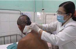 Bác sĩ cảnh báo nhiều trường hợp bị zona thần kinh biến chứng nặng phải nhập viện