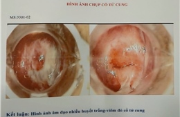 TP Hồ Chí Minh: Phát hiện hàng trăm hình ảnh nội soi cổ tử cung ‘vô danh’ tại một phòng khám