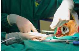 Bác sĩ cảnh báo bệnh răng miệng âm thầm gây mất răng sớm ở người trẻ