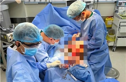 Phẫu thuật bảo tồn chân cho bệnh nhân người Campuchia nhập viện muộn