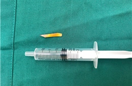 Phẫu thuật cứu cụ bà 104 tuổi bị mảnh gỗ 2cm vật đâm thủng ruột non