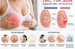  Bác sĩ cảnh báo biến chứng viêm vú khi tự 'thông tia' sữa