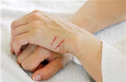 Nga chế xuất vật liệu tự chữa lành vết thương
