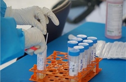  Hà Nội ghi nhận thêm 52 ca nhiễm SARS-CoV-2