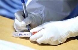 Hà Nội ghi nhận kỷ lục 289 ca nhiễm SARS-CoV-2 trong ngày 15/11