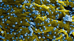 CDC Mỹ cảnh báo nguy cơ virus Marburg lây lan từ châu Phi